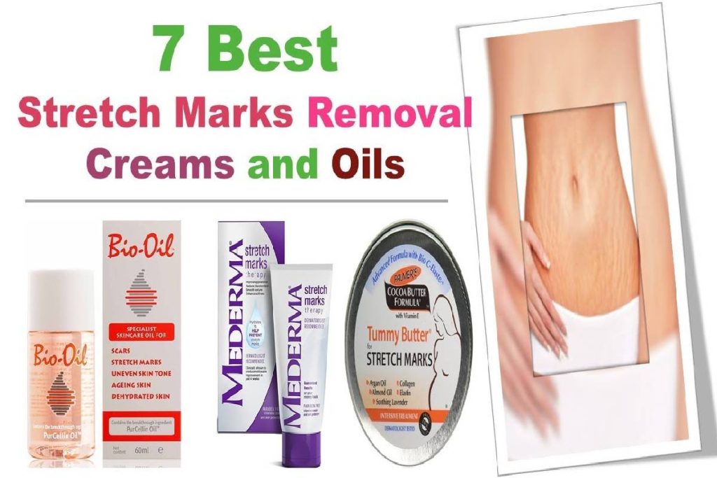 best cream to lighten stretch marks
