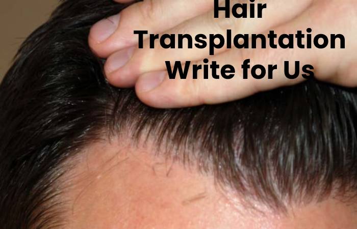 Hair Transplantation Write For Us