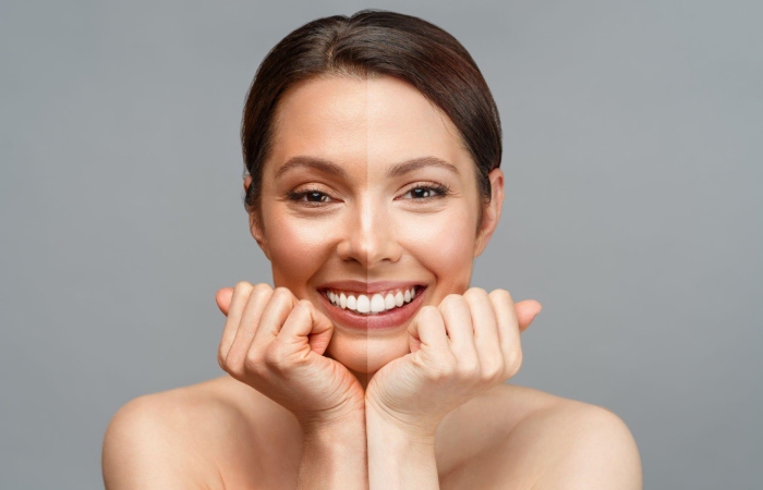 Skin Whitening write for us