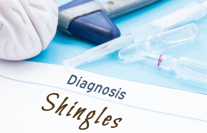 Shingles Write for Us