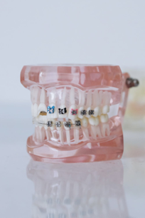 The Evolution of Orthodontics