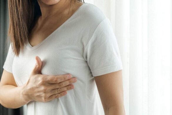 Breast Cancer Write for Us