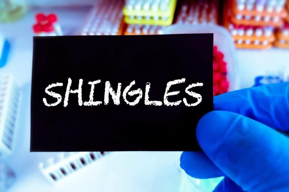Shingles Write for Us