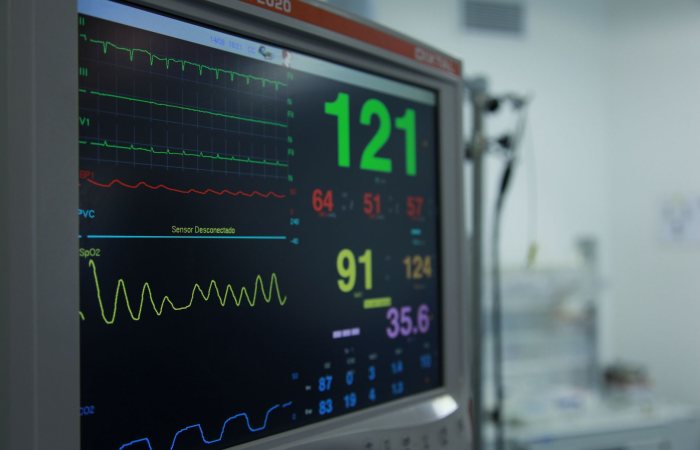 Close-up view of a vital signs monitor showing various medical readings in a hospital setting.